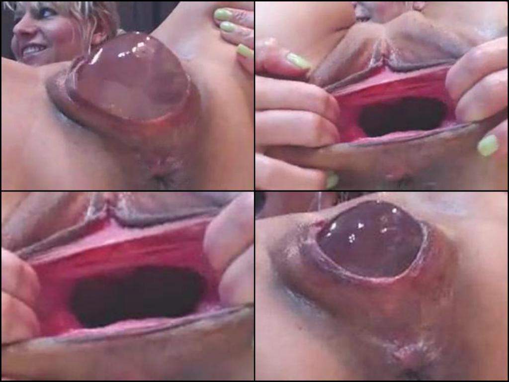 Head inserted into pussy - 🧡 Foreign body insertion erotic image w who get...
