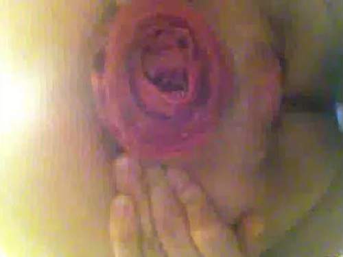 Kinky webcam girl closeup giant prolapse anal play