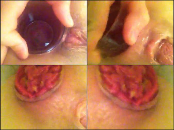 transparent glass anal penetration close up,transparent glass anal fuck,prolapse anus very close