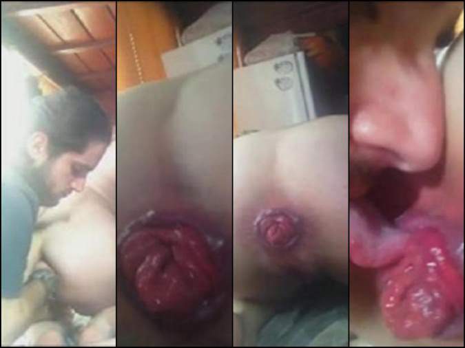 Extreme Homemade Video Asshole Prolapse Licking Amateur Fetishist