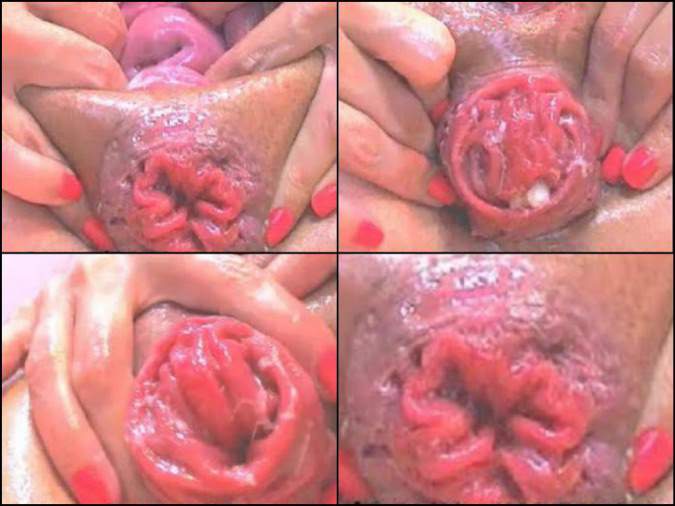 cervix closeup asshole prolapse,giant prolapse anus,very close cervix russian Raisa