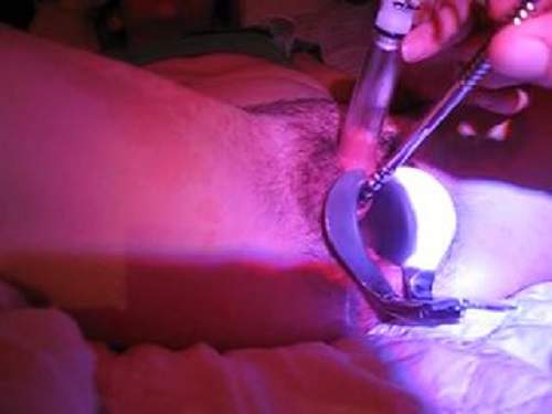 Amazing mature clitoris pumping and urethra insertion