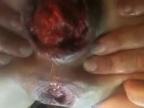 penetration object Incredible anal
