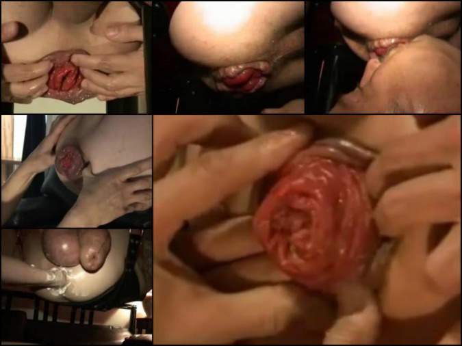 monster size prolapse anal male,crazy male fisting and giant prolapse