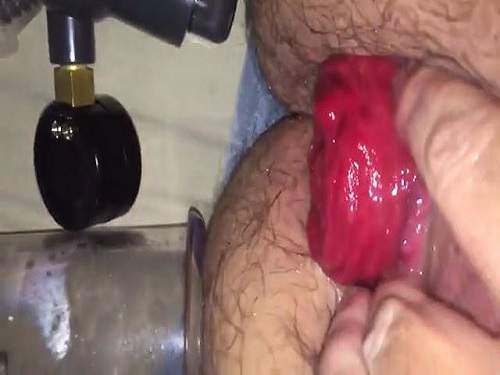 Monster size anal prolapse after ass pumping