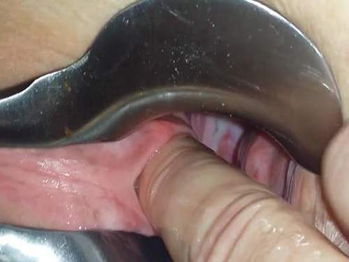 Husband penetrated finger into urethra his wife