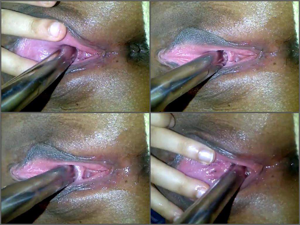 Nystatin vaginal inserts