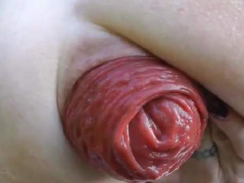 epic anus prolapse,giant anal prolapse show,stretched giant asshole,fisting anal deep,outdoor amateur fisting