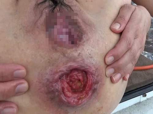 Auto anal rosebud falls hot hairy asian wife