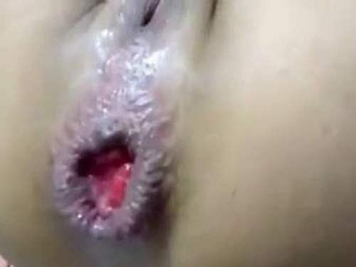 Anal gape and rosebutt loose very closeup to wife