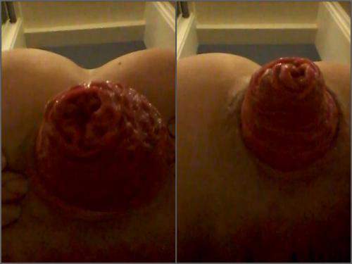 Anal prolapse loose compilation mature homemade 2 videos