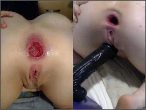 Webcam big ass girl insertion dildo in huge prolapse and gape