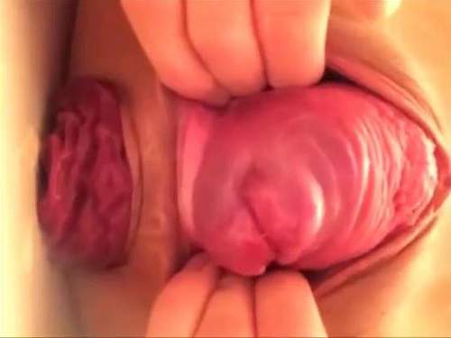 Amateur Japanese girl again stretching her huge prolapse and monster cervix