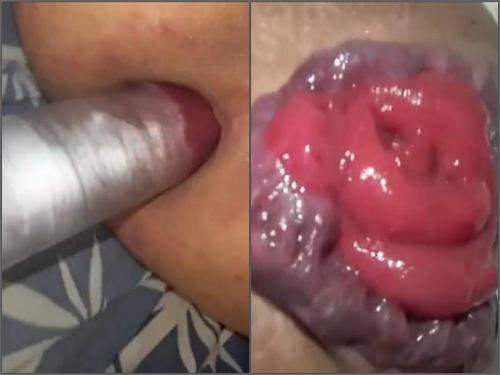Amateur male HungryAss_1992 pump her giant prolapse anal