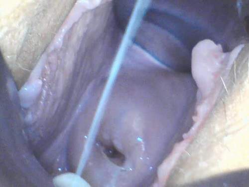 Milly17 covering my cervix in cumendo,Milly17 speculum,Milly17 urethra,speculum pussy,urethral sounding,cumshot in pussy