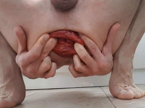 Amateur male hardcore stretching his giant anal prolapse
