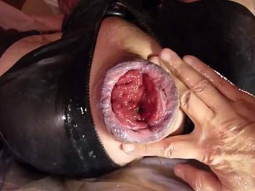 Gays extremely anal prolapse porn during fisting sex homemade POV