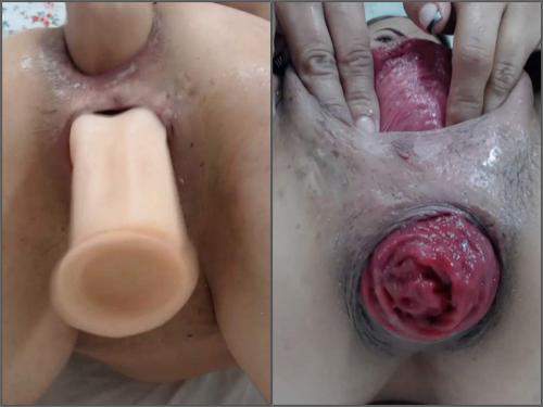 Carolinauribe again anal prolapse and pussy ruined