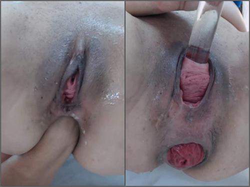 Webcam latina Carolinauribe cervix stretching and loose prolapse anal hardcore