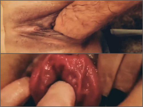deep fisting,fisting sex,girl gets fisted,vaginal fisting video,vaginal prolapse porn