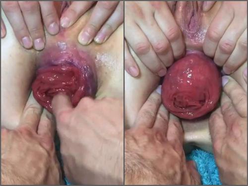 Tawney Mae POV show her giant anal prolapse very close-up