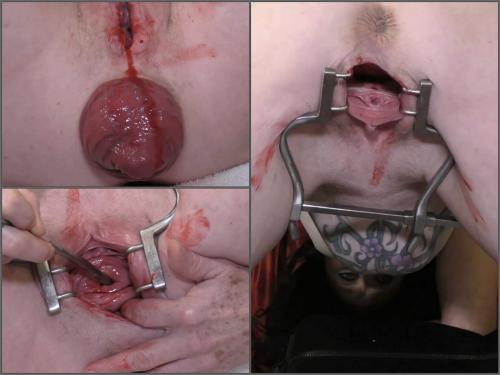 Bloody period speculum examination with dirty brunette