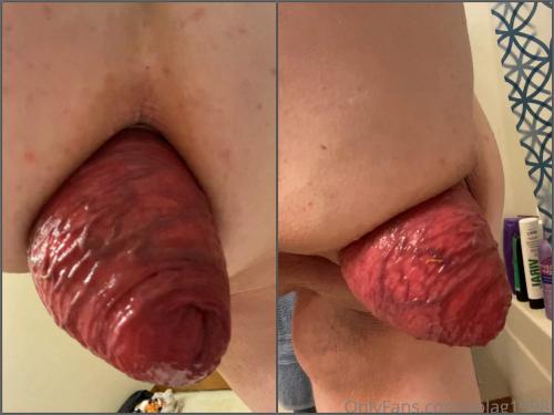 Fatty pornstar Solag1998 sexy anal prolapse loose POV amateur