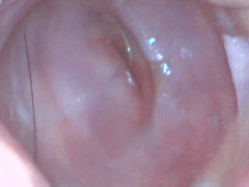 Russian girl Moon Christine Cervix close up with endoscope