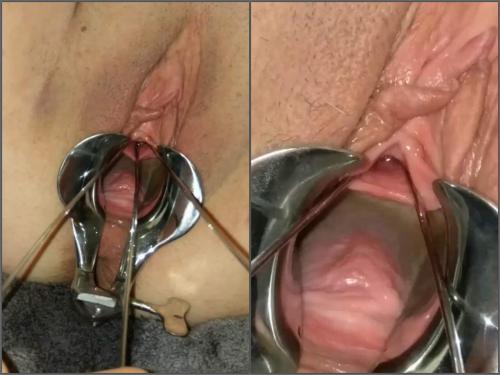 Amateur POV medical fetish porn with hot wife Urethral_Play