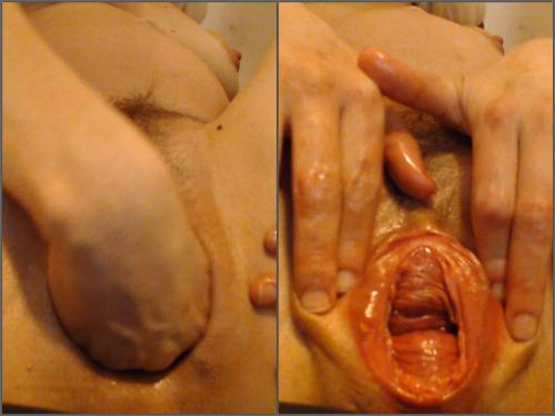 WildValkyria fisting my pregnant huge pussy and cum,WildValkyria pussy fisting,deep fisting,girl gets fisted,cervix porn,cervix loose,show cervix,vaginal gape