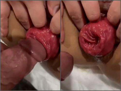 500px x 375px - Prolapsefucking | Brunette Aydyr Multiple Squirting Session Having My  Prolapsed Ass Fucked