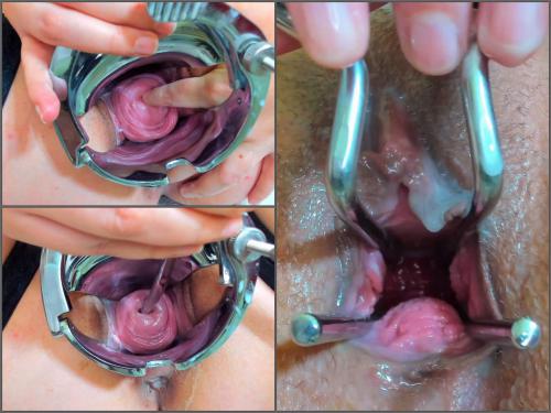 Andradahot Medical Inspection inside my Cervix closeup – Premium user Request