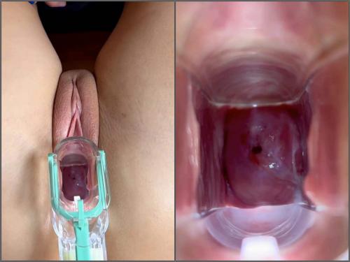 Stella St Rose Hot Girl Lets Us Explore Her Cervix with speculum