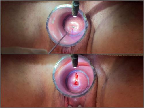 Electrasexual Dilating Cervix,Electrasexual 2024,Electrasexual speculum examination,Electrasexual cervix loose,cervix stretching video,pussy stretching,vaginal porn,urethral sounding,sounding porn video